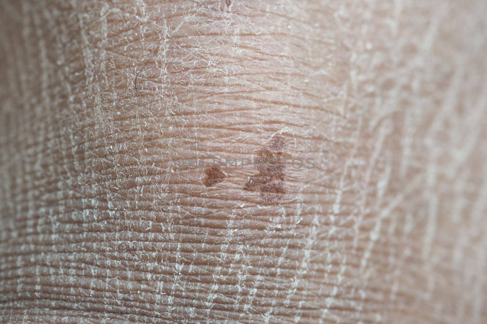 Skin surface displays detailed texture and small brown spots.
