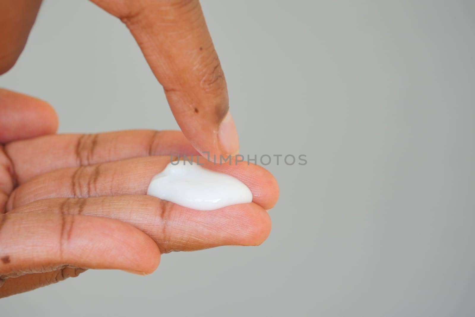 A person gently applies a small amount of cream on their hand.