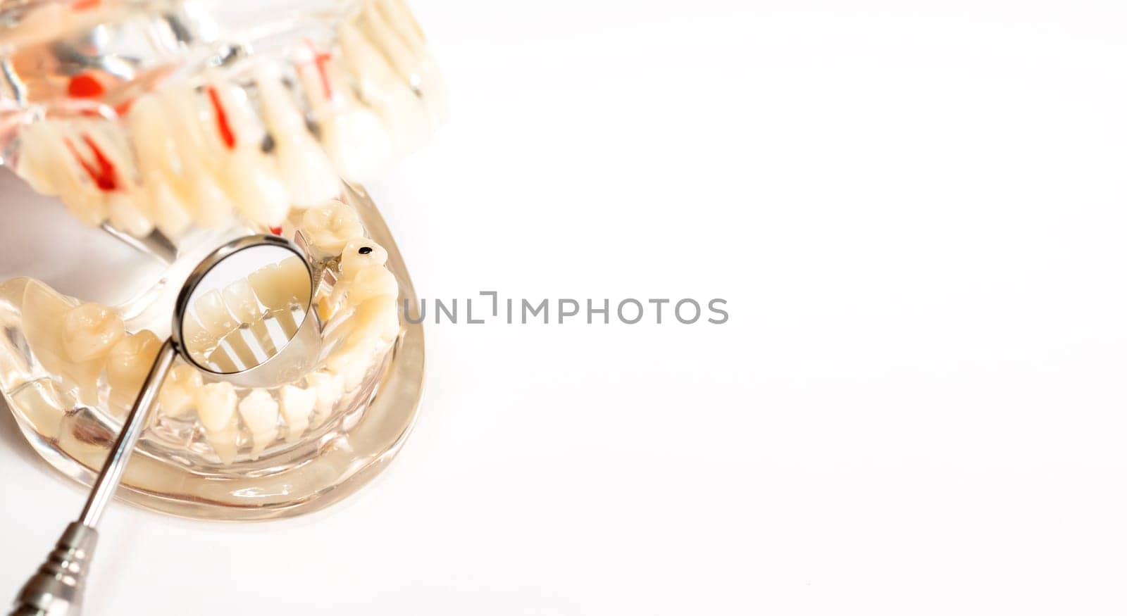 Mockup Dental Concept. Basic Dental Instruments Set, Mirror Anatomical Teeth Model. Copy Space. Oral Hygiene , Dental Care. Transparent Disease Tooth Model with Implant Bridge.Horizontal
