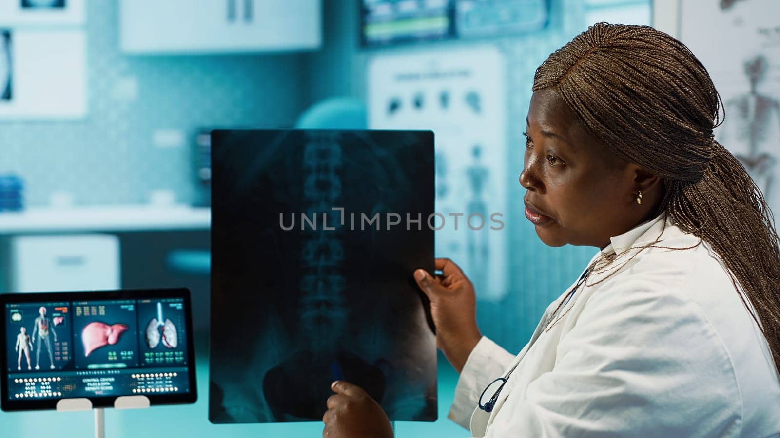 Medical professional explaining the x ray imaging for a diagnosis, doing scan interpretation during check up visit. African american female medic gives feedback to male client. Camera A.