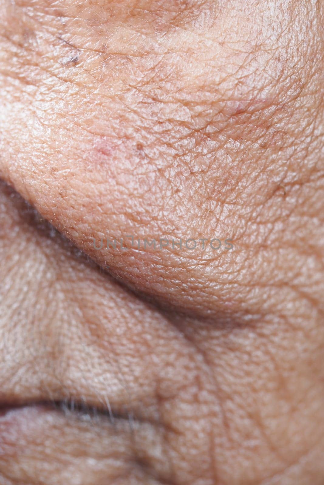 Detailed depiction of skin texture showing wrinkles and fine lines.