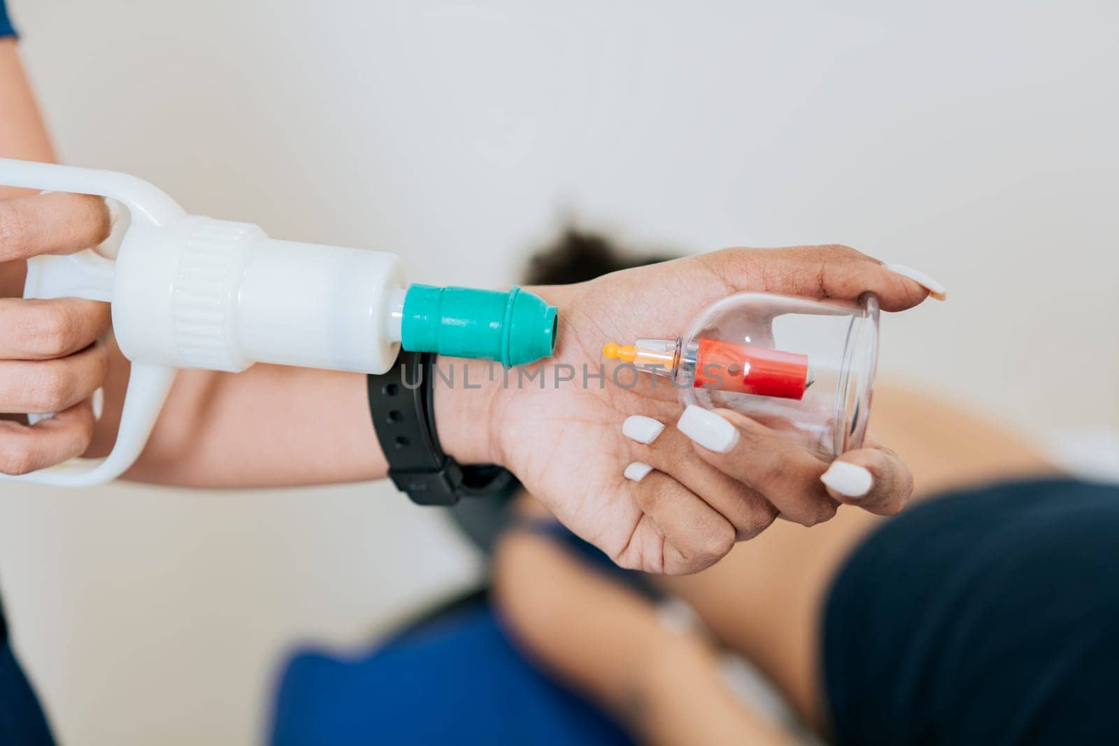 Close up of professional performing cupping treatment on patient, Modern Physiotherapy with cupping cups, Physiotherapist placing cupping on lying patient