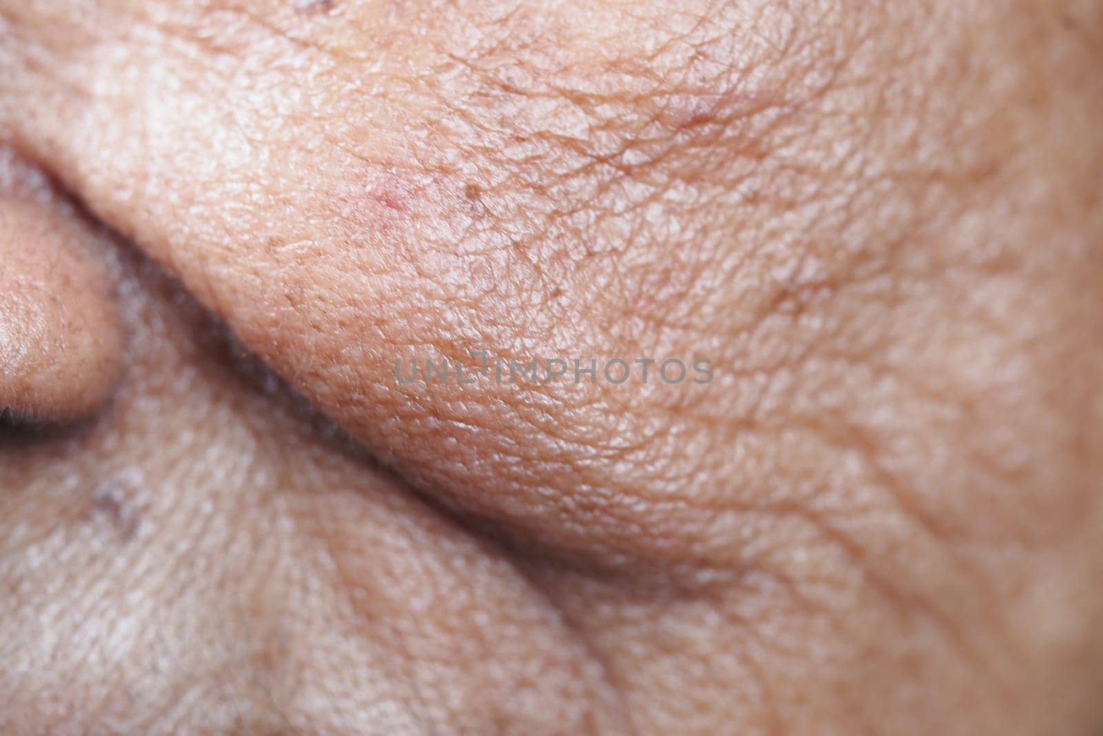 Detailed view showing wrinkles and texture of elderly skin on face