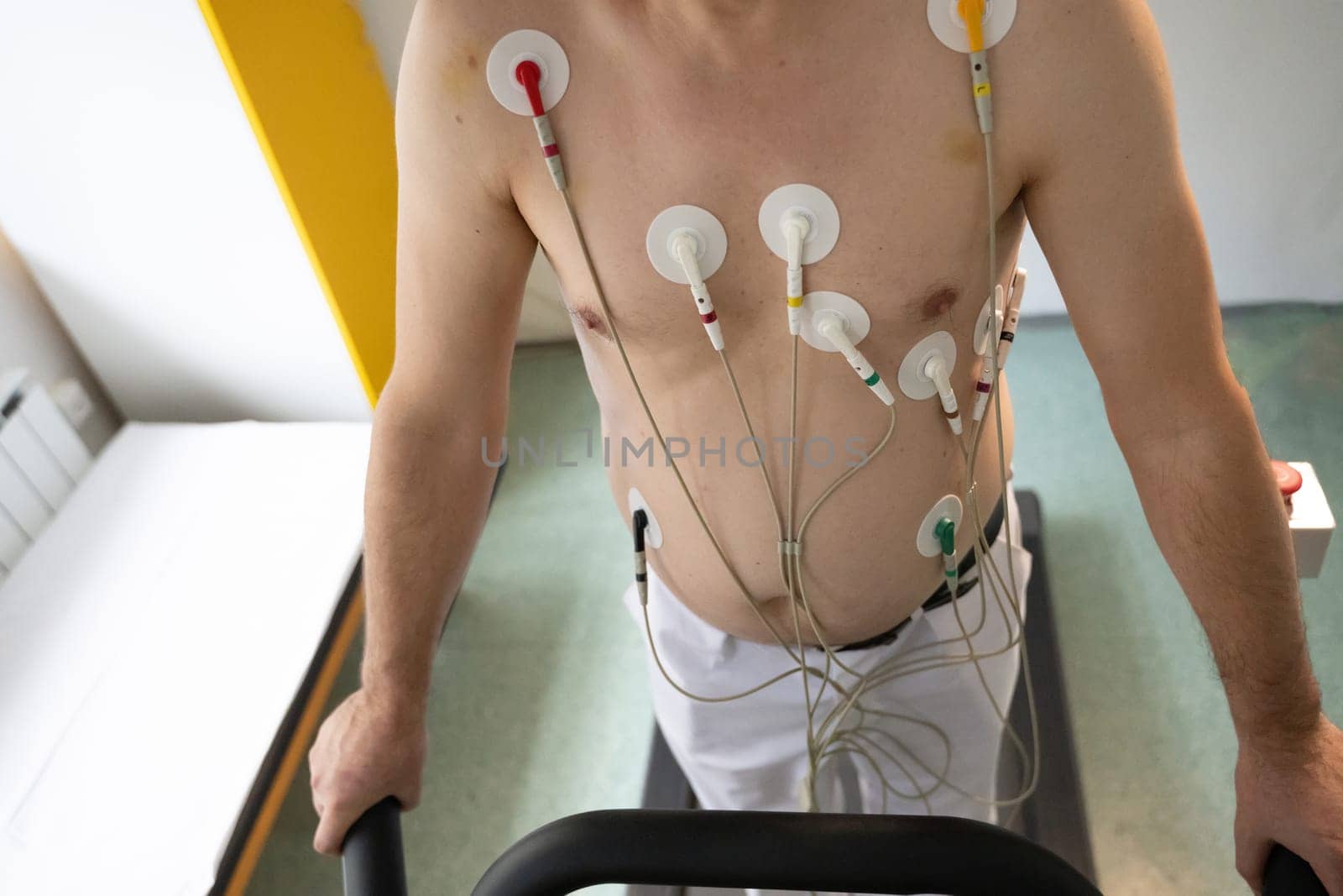A middle-aged man is undergoing a medical stress test on a treadmill, connected to ECG electrodes for heart monitoring in a clinical environment.
