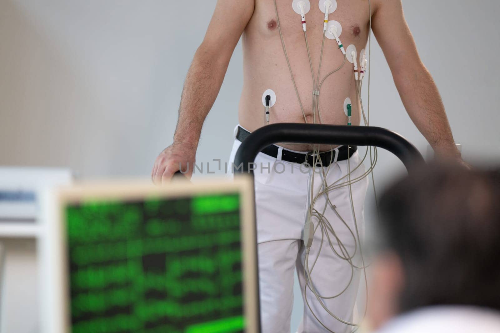 A middle-aged man is undergoing a medical stress test on a treadmill, connected to ECG electrodes for heart monitoring in a clinical environment.