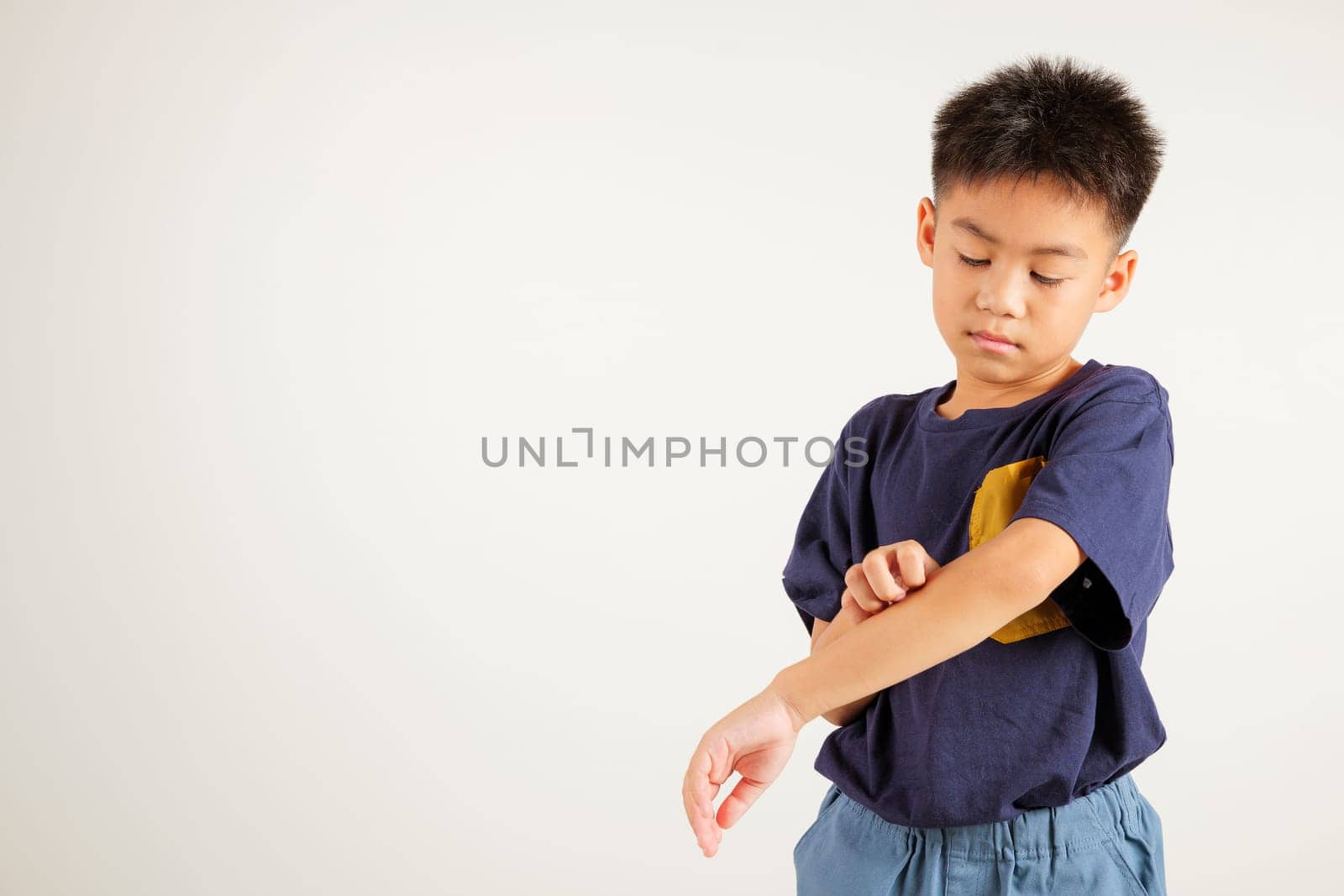 Asian little kid boy scratching itchy arm from a mosquito bite at studio shot isolated on white background, Portrait of Thai primary child dermatitis and scabies, Allergy symptoms, Malaria day concept