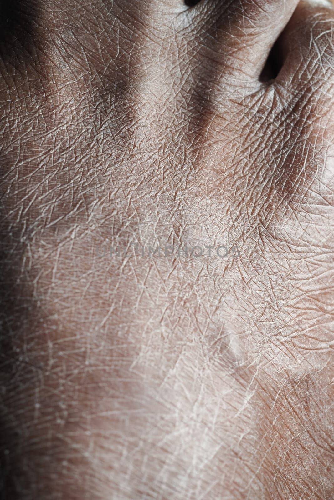 Close-up view of dry feet ,