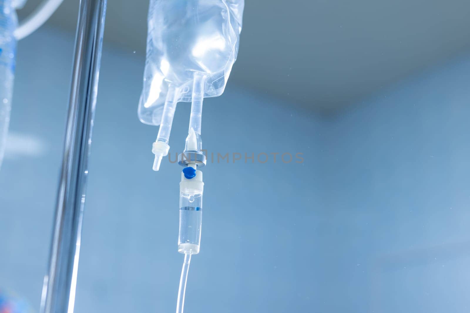 Close-up of IV infusion system with clear fluid bag in a hospital setting, used for patient hydration and treatment.