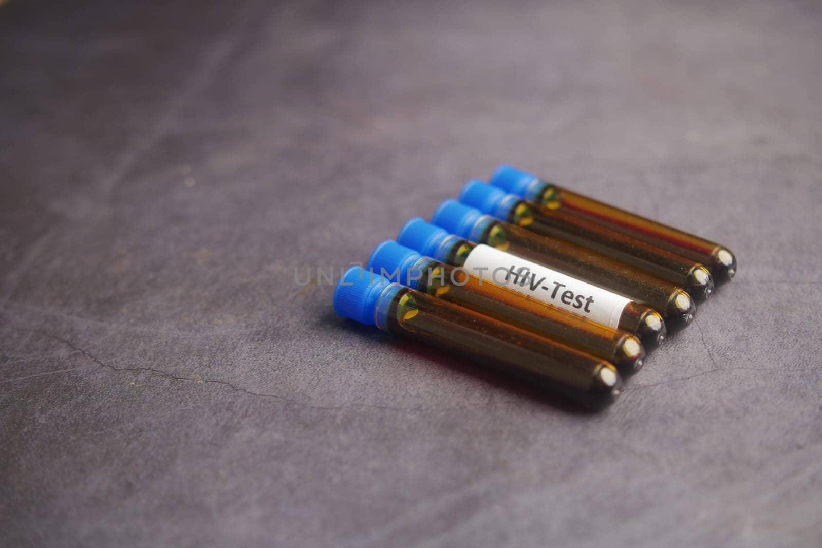 Group of HIV test vials arranged on a dark laboratory surface.