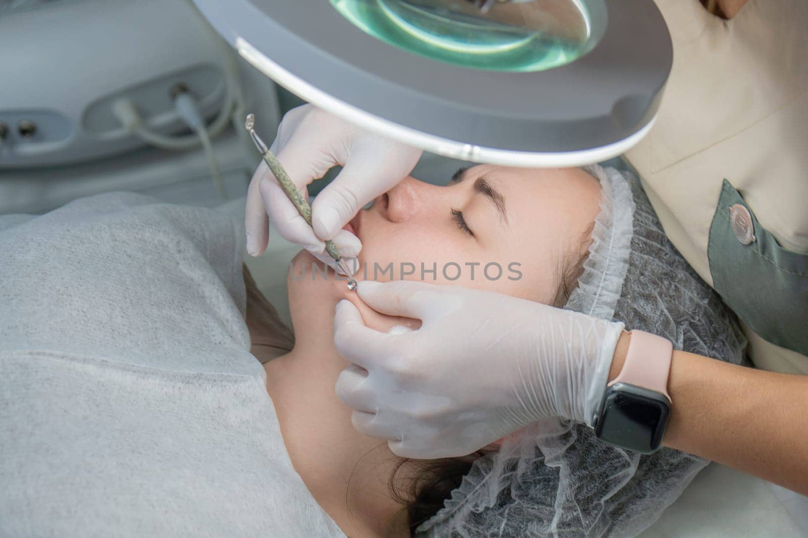 Close-up of a woman receiving a facial treatment. A technician uses a small tool to cleanse her skin under a magnifying lamp. Gloves and a hygienic head covering are visible.