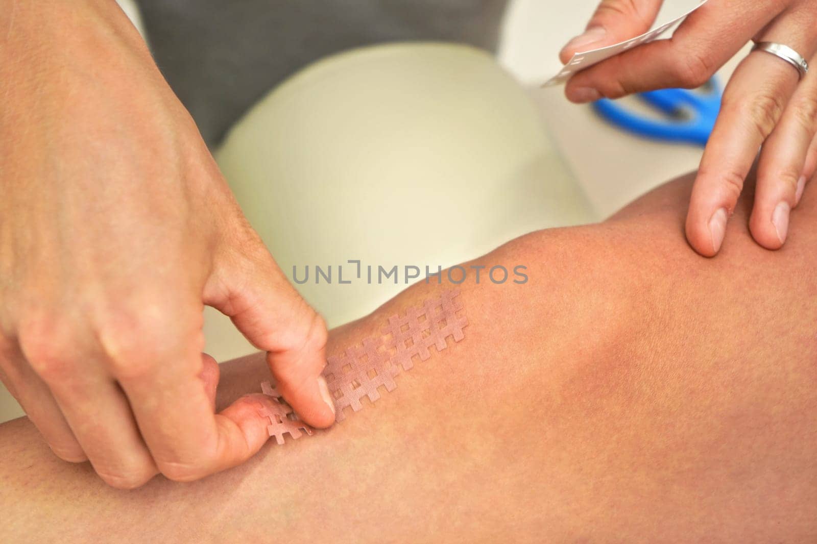 Skin coloured kinesiology grid tape applied on knee of patient, closeup detail