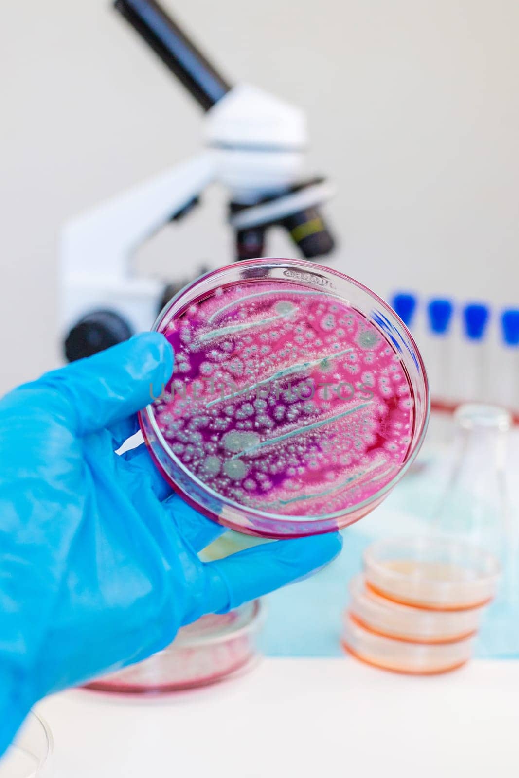 Examine bacteria in petri dishes in the laboratory. Selective focus. nature.