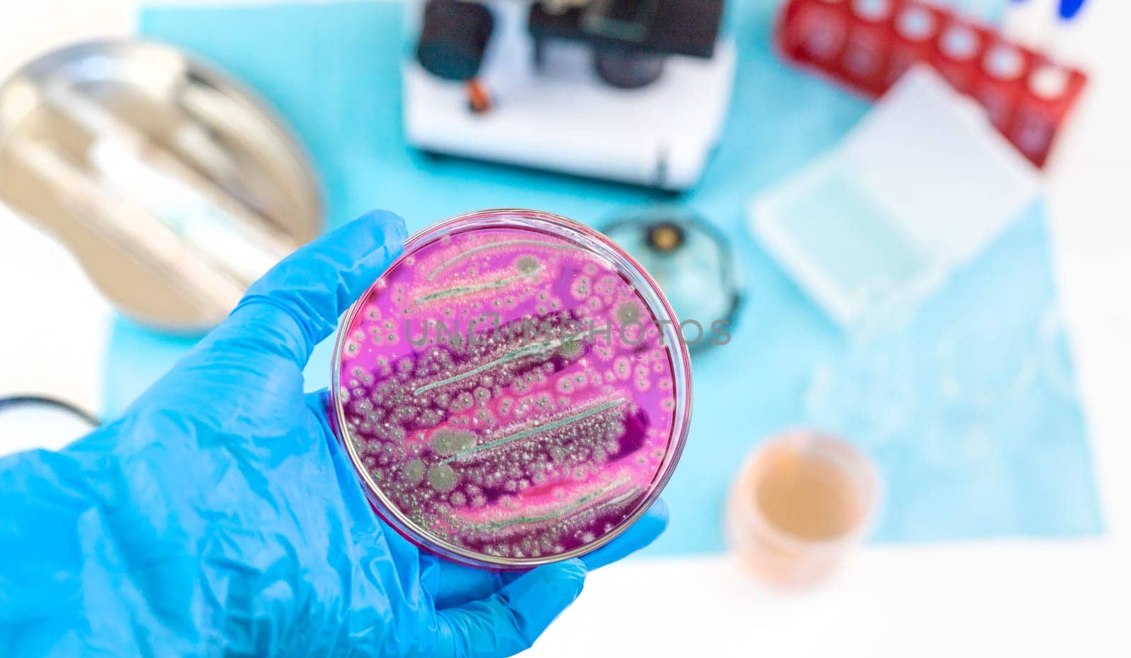 Examine bacteria in petri dishes in the laboratory. Selective focus. nature.