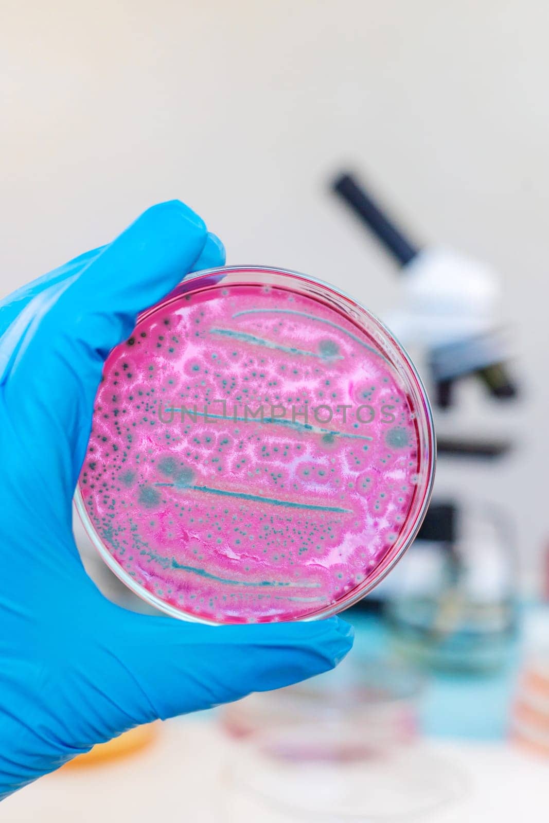 Examine bacteria in petri dishes in the laboratory. Selective focus. nature.