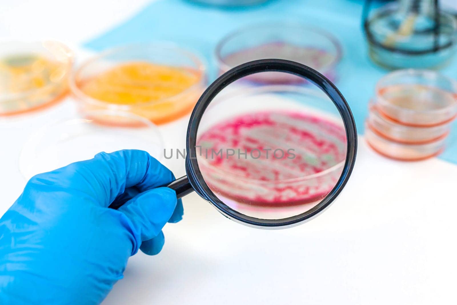 Examine bacteria in petri dishes in the laboratory. Selective focus. nature.