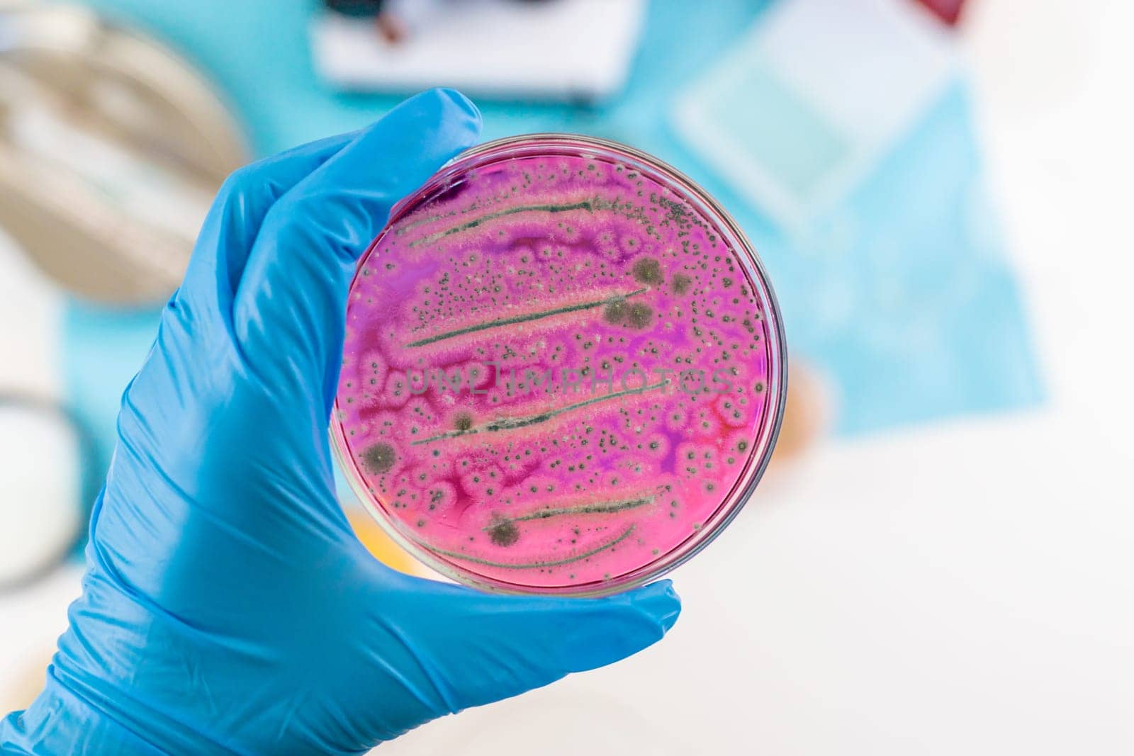 Examine bacteria in petri dishes in the laboratory. Selective focus. nature.