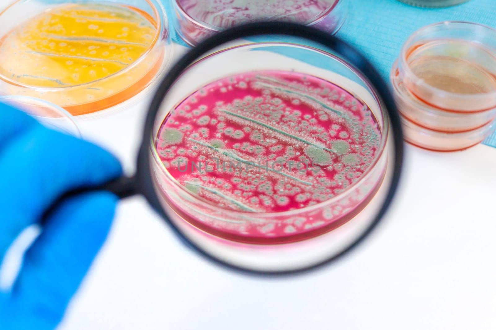 Examine bacteria in petri dishes in the laboratory. Selective focus. nature.
