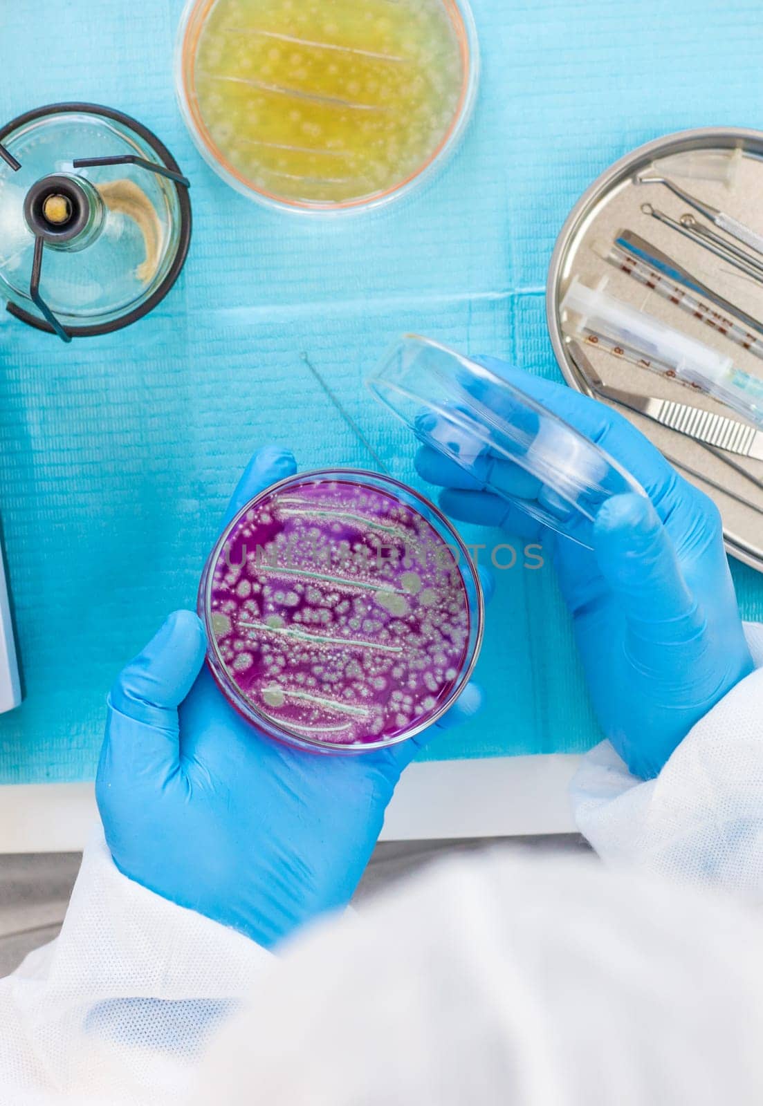 Examine bacteria in petri dishes in the laboratory. Selective focus. nature.