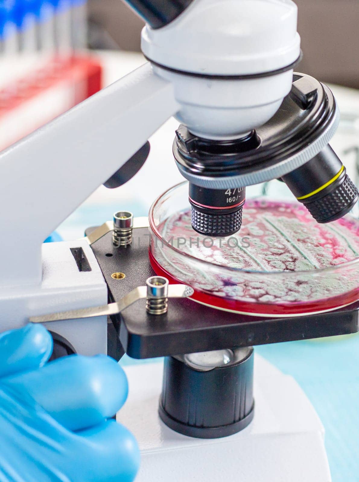 Examine bacteria in petri dishes in the laboratory. Selective focus. nature.