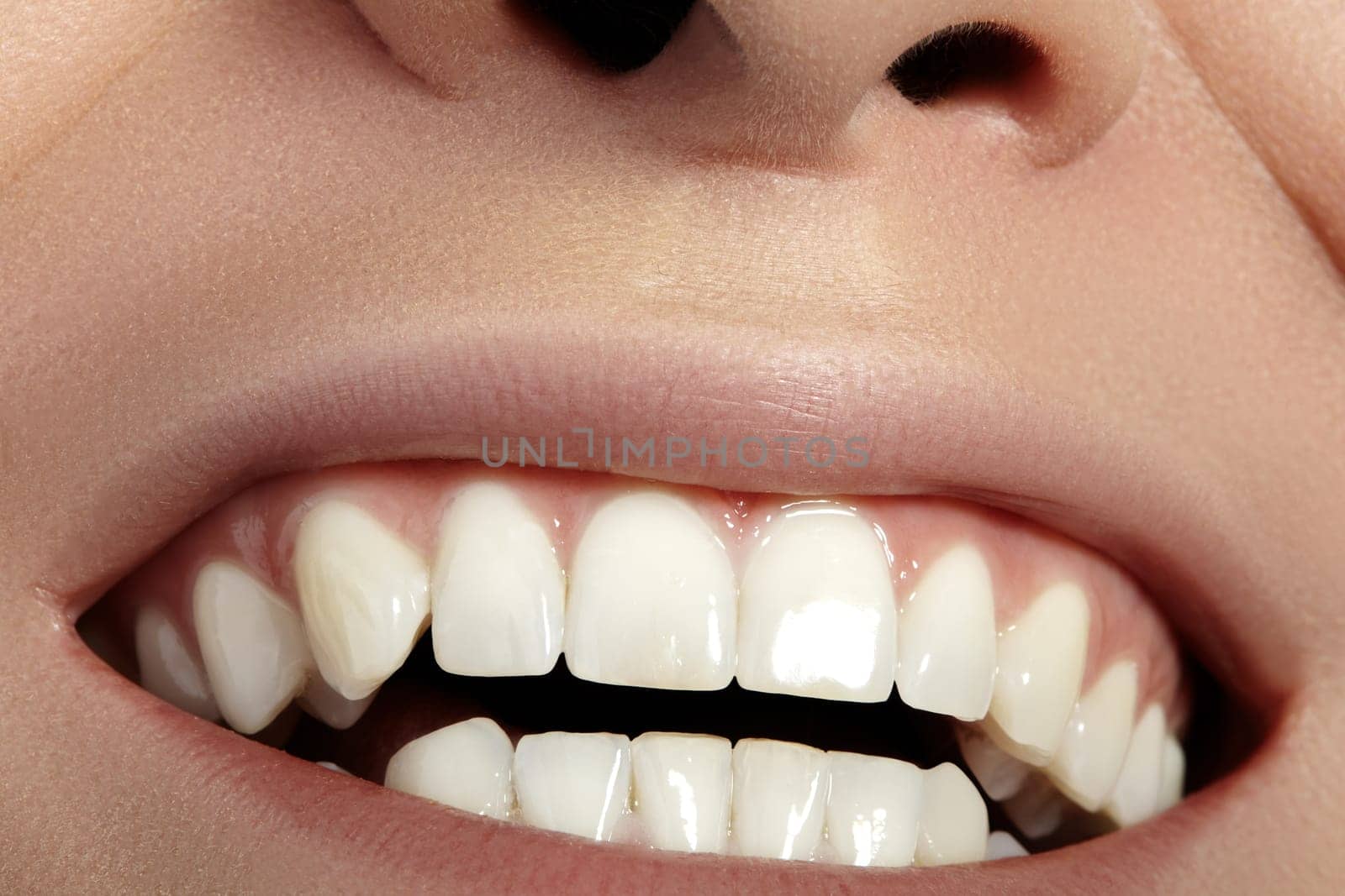 Closeup Dental Beauty. Beautiful Macro with perfect White Teeth. Fashion Naturel Lips Make-up. Whitening Tooth and Wellness Treatment
