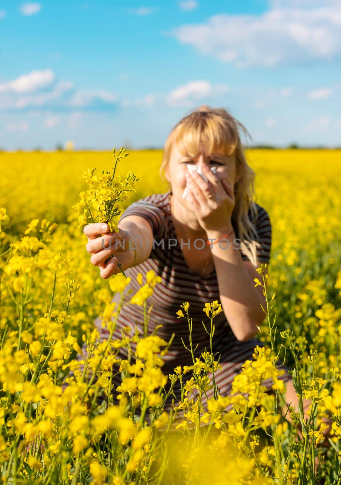 Yellow field flowers allergy. Selective focus. nature.