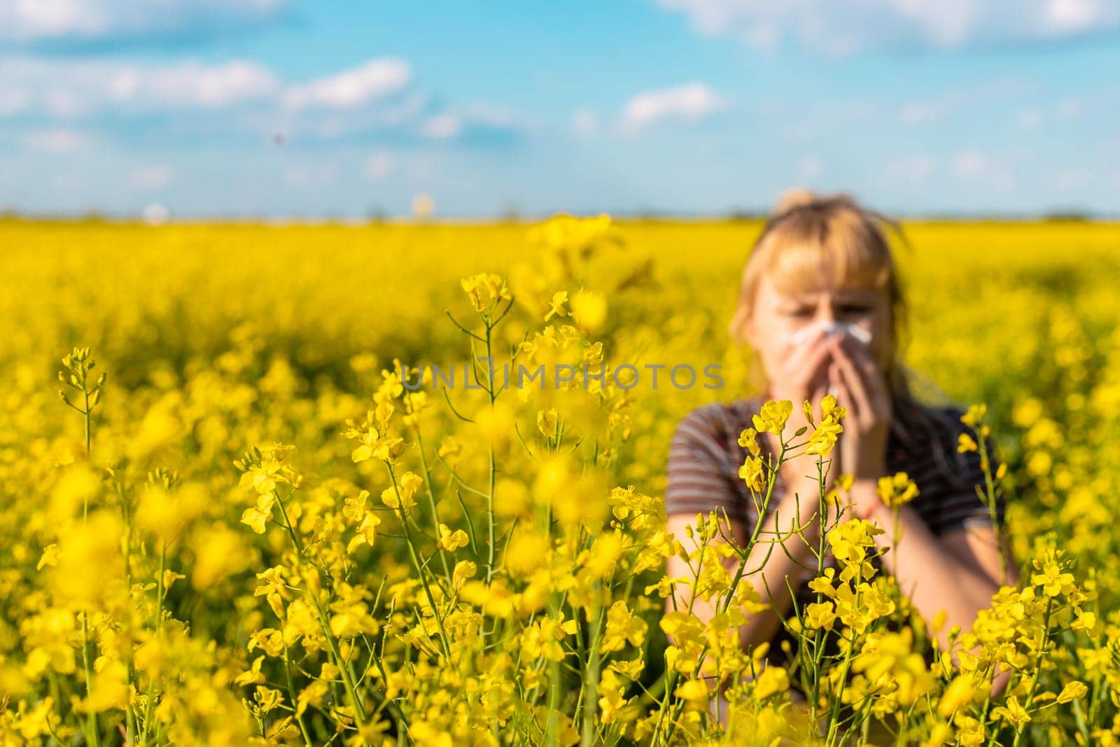 Yellow field flowers allergy. Selective focus. nature.