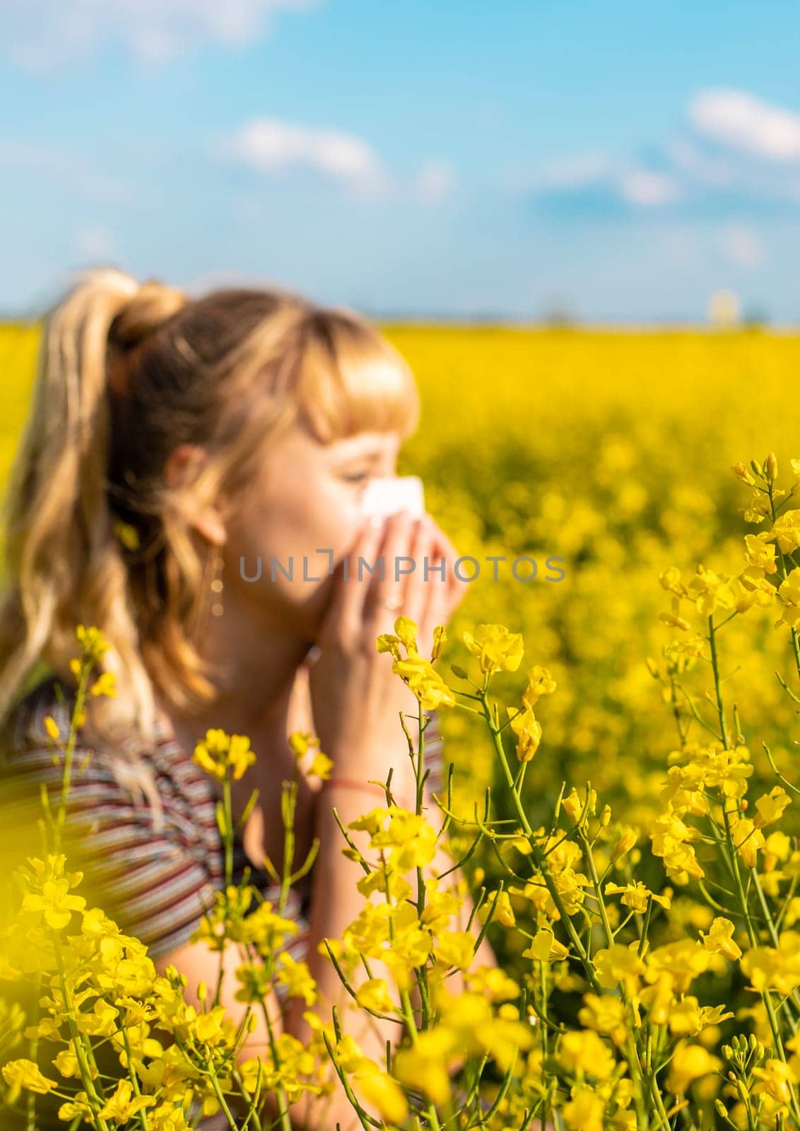 Yellow field flowers allergy. Selective focus. nature.
