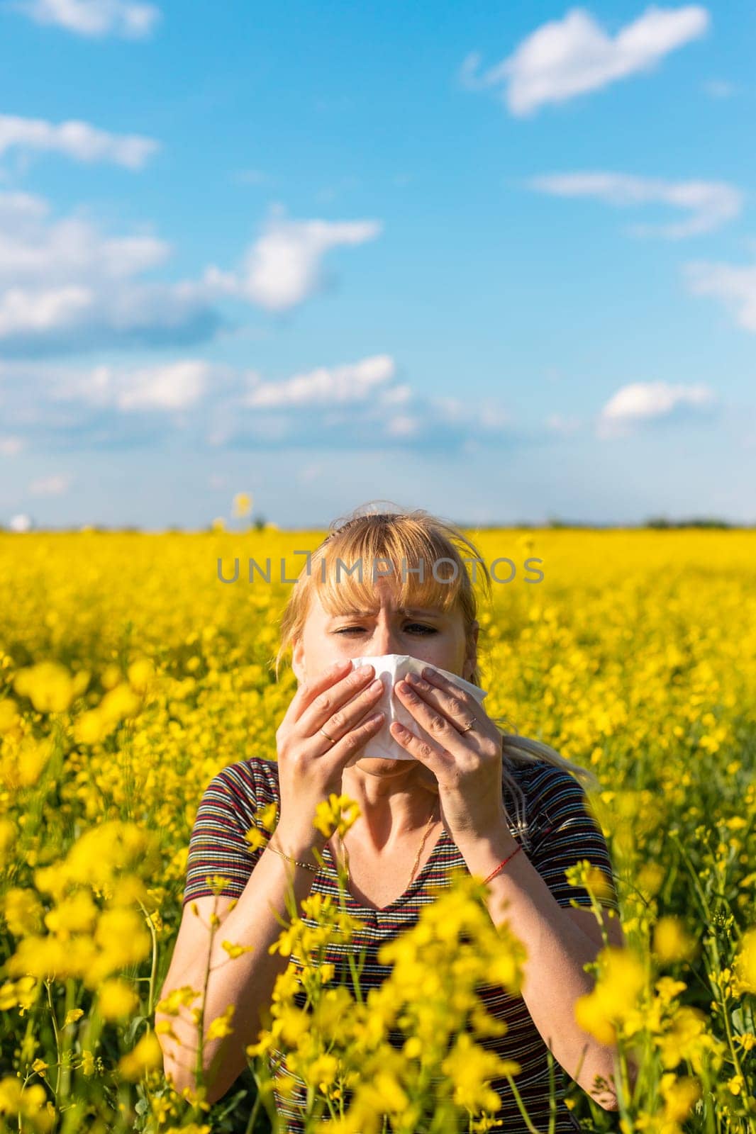 Yellow field flowers allergy. Selective focus. nature.
