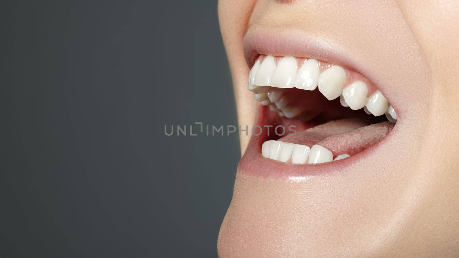 Closeup Dental Beauty. Beautiful Macro with perfect White Teeth. Fashion Naturel Lips Make-up. Whitening Tooth and Wellness Treatment