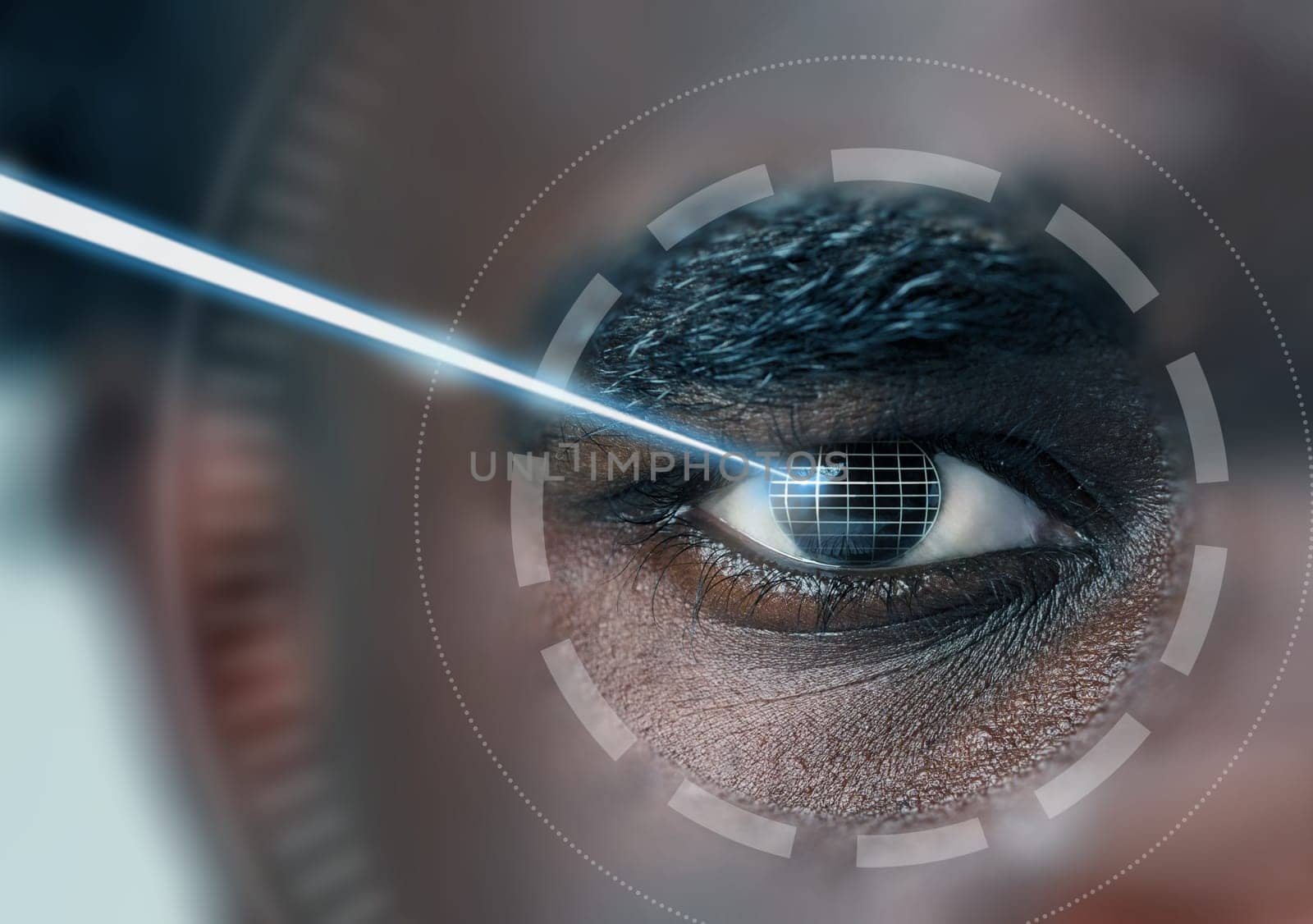 A detailed view of a person's eye during a high-tech examination procedure aimed at improving vision clarity through laser technology in a clinical setting.