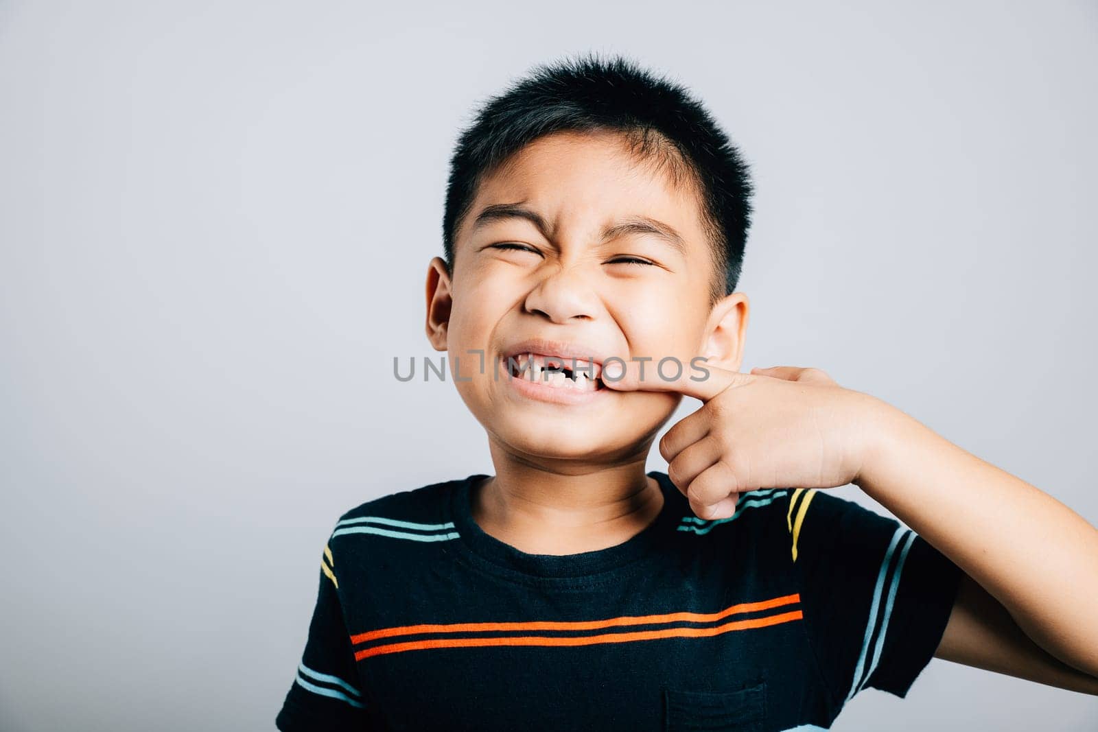 Asian boy showcasing dentistry pointing to missing front tooth. Health care concept isolated on white background emphasizing child dental growth and care. Children show teeth gap, dentist problems