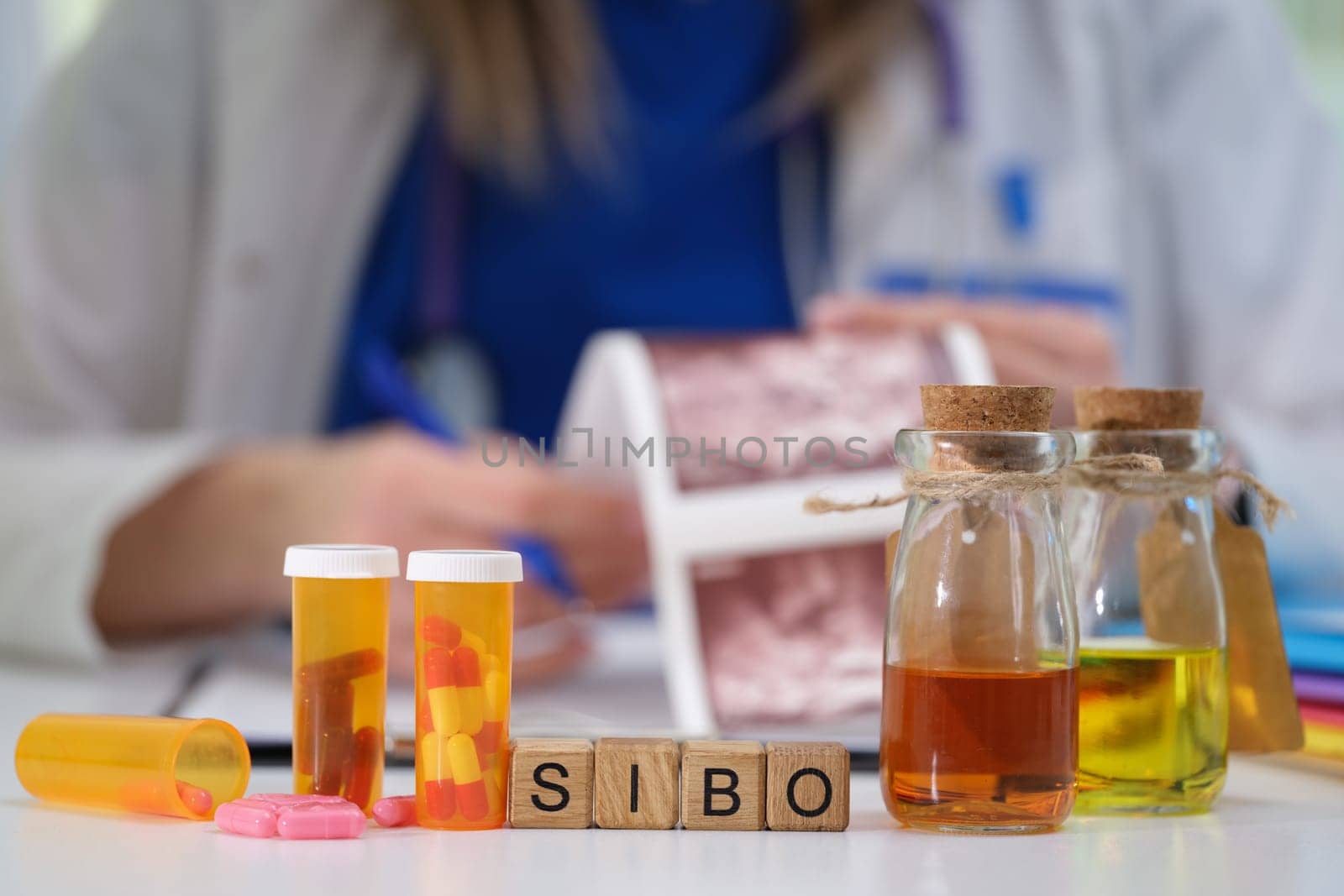 Exploring treatment options for SIBO, including medications, consultations, and expert medical advice