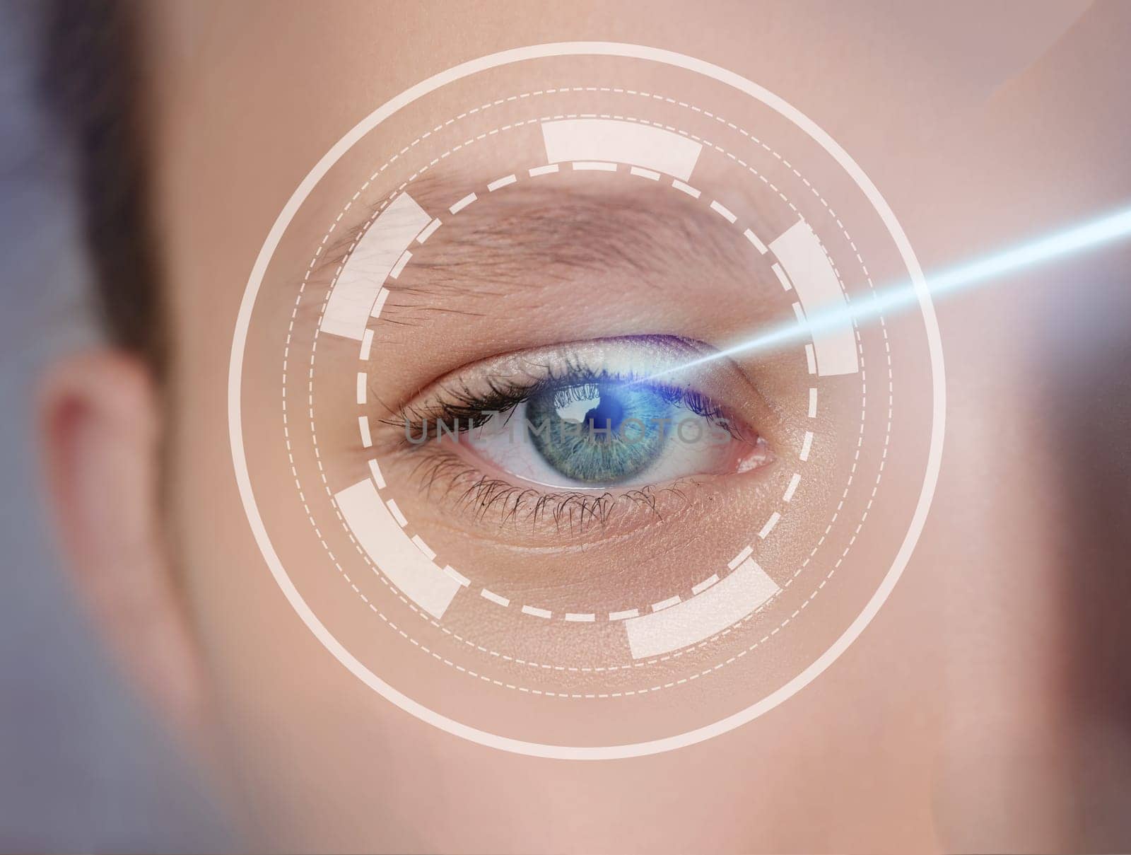 A patient receives innovative laser vision correction therapy in a modern clinic. The procedure focuses on improving eyesight with cutting-edge technology and skilled professionals.