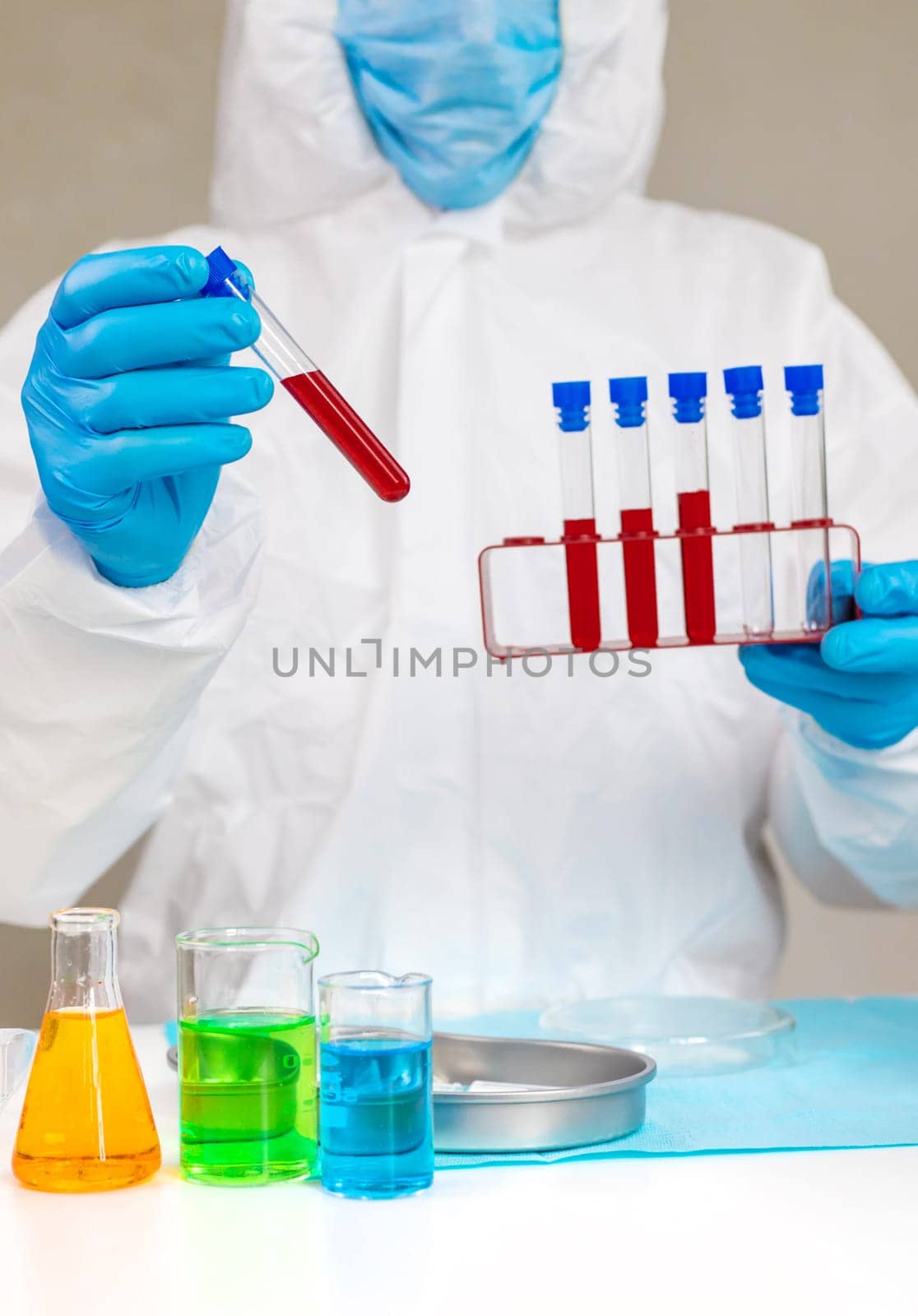 examine blood in the laboratory. Selective focus. medicine.