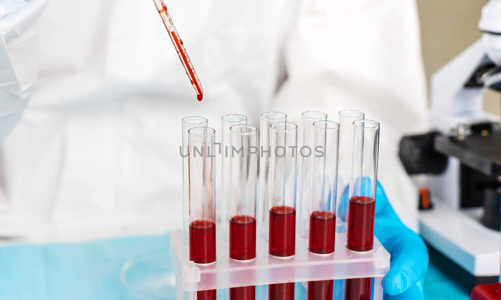 examine blood in the laboratory. Selective focus. medicine.