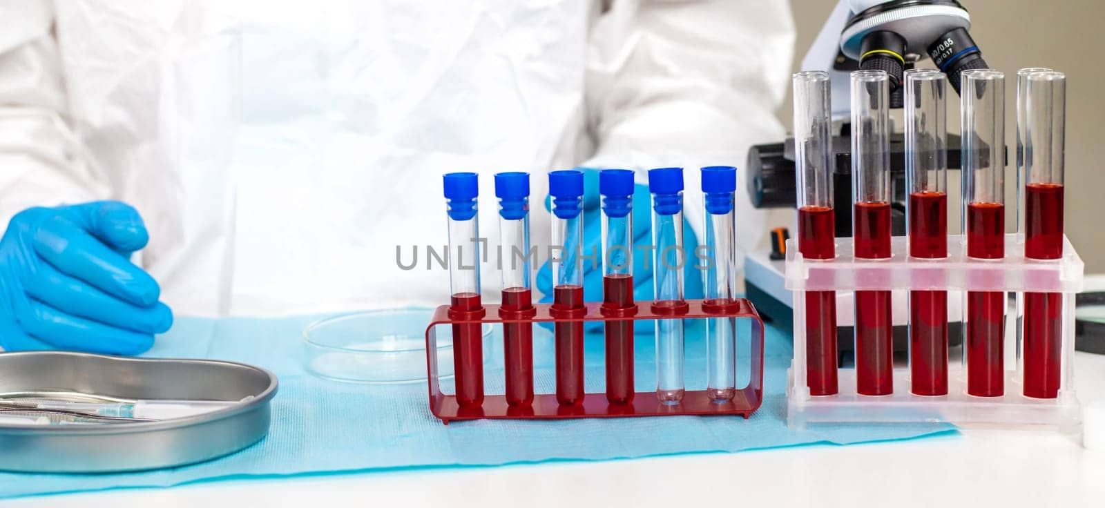 examine blood in the laboratory. Selective focus. medicine.