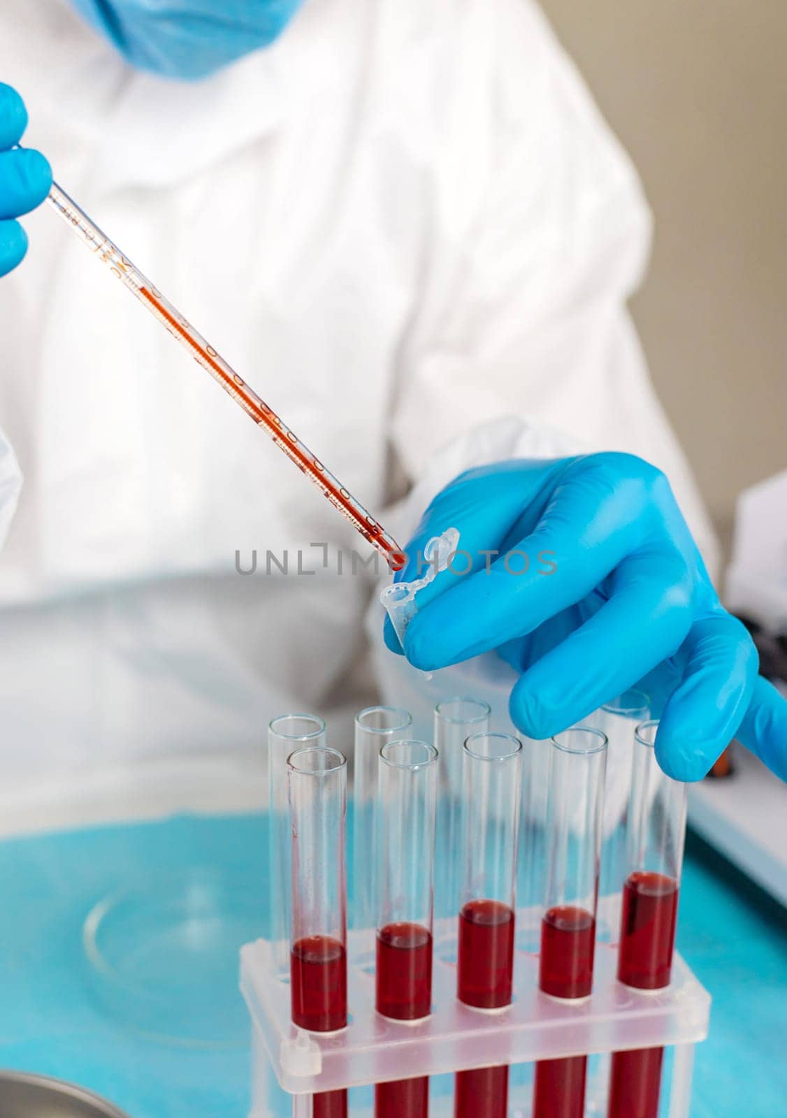 examine blood in the laboratory. Selective focus. medicine.