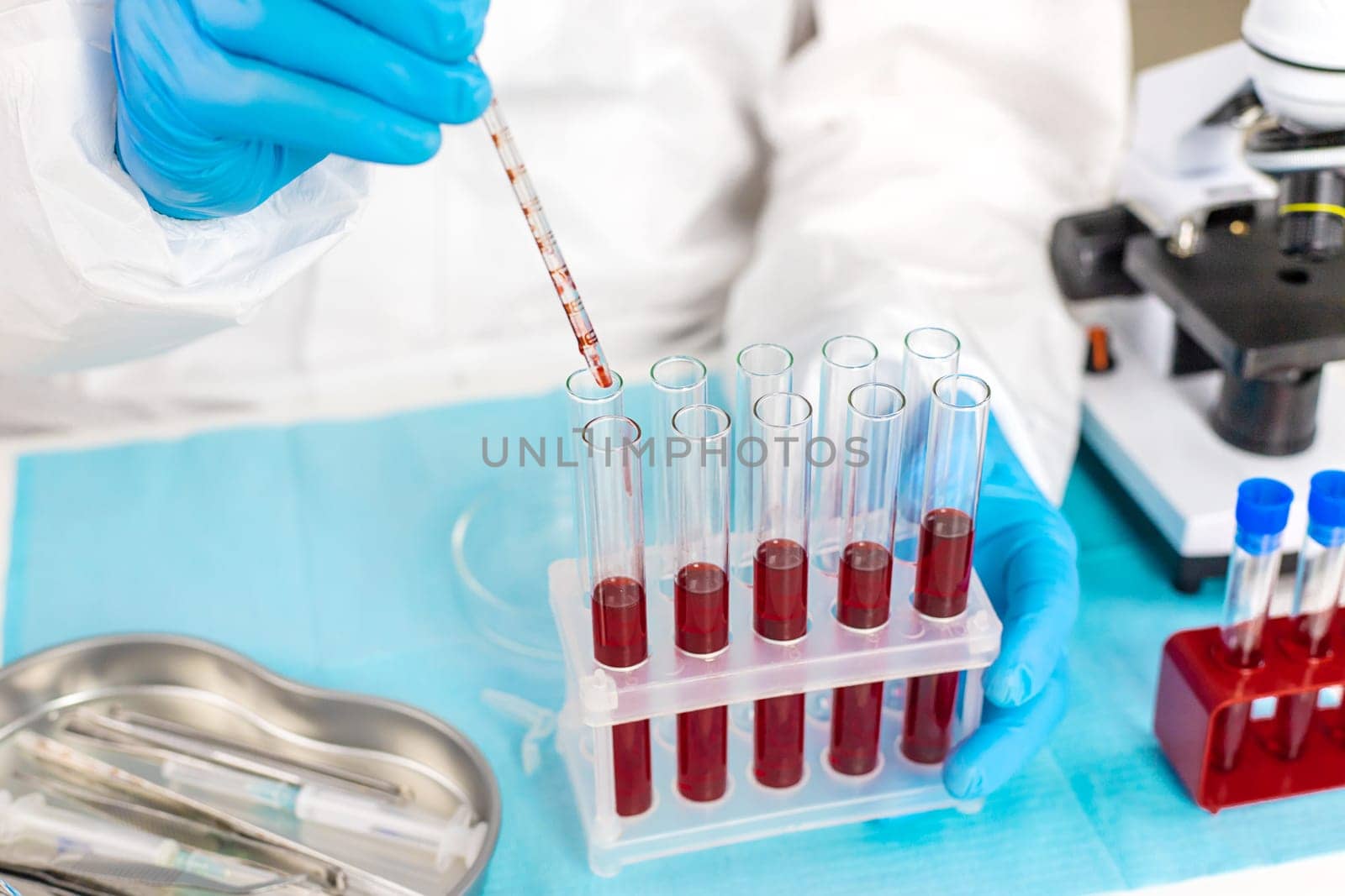 examine blood in the laboratory. Selective focus. medicine.