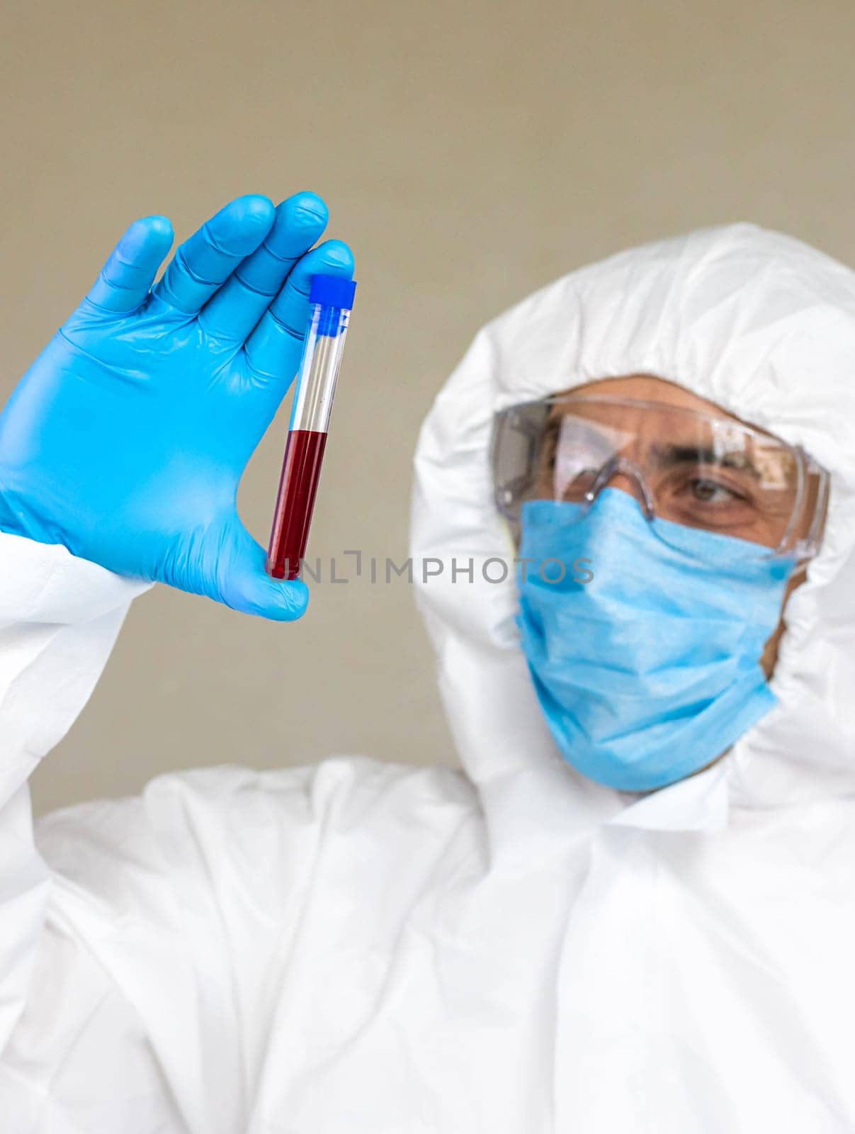 examine blood in the laboratory. Selective focus. medicine.