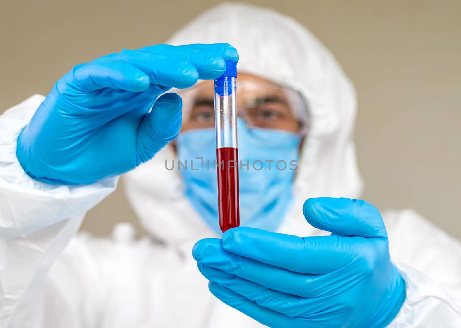 examine blood in the laboratory. Selective focus. medicine.