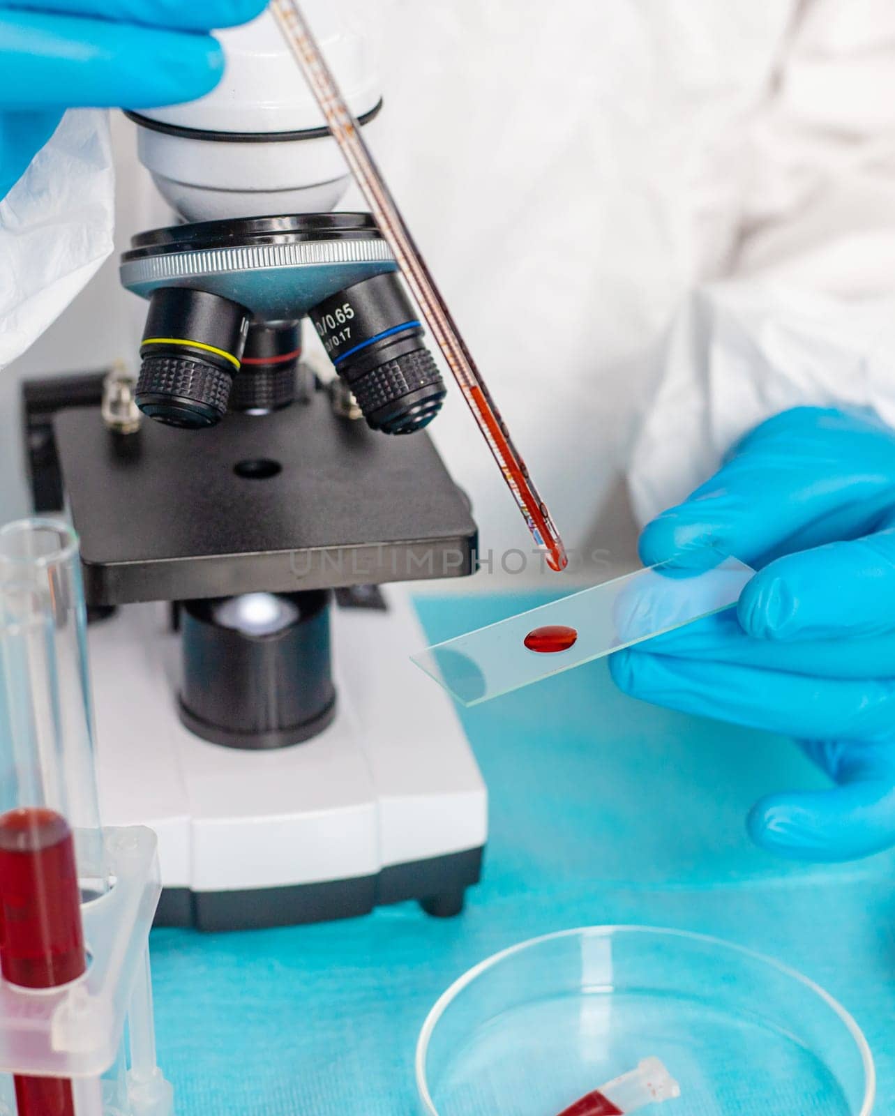 examine blood in the laboratory. Selective focus. medicine.