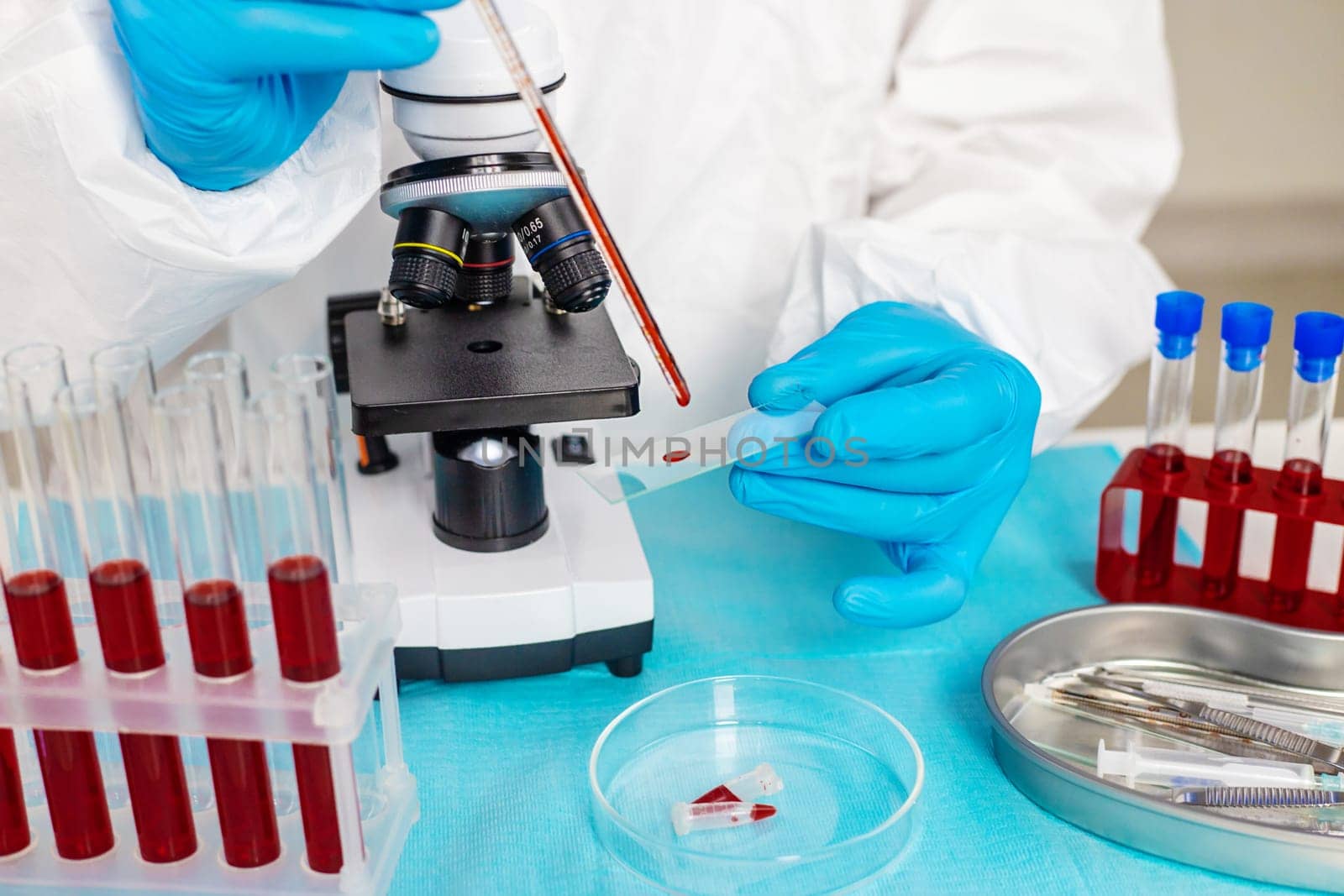 examine blood in the laboratory. Selective focus. medicine.