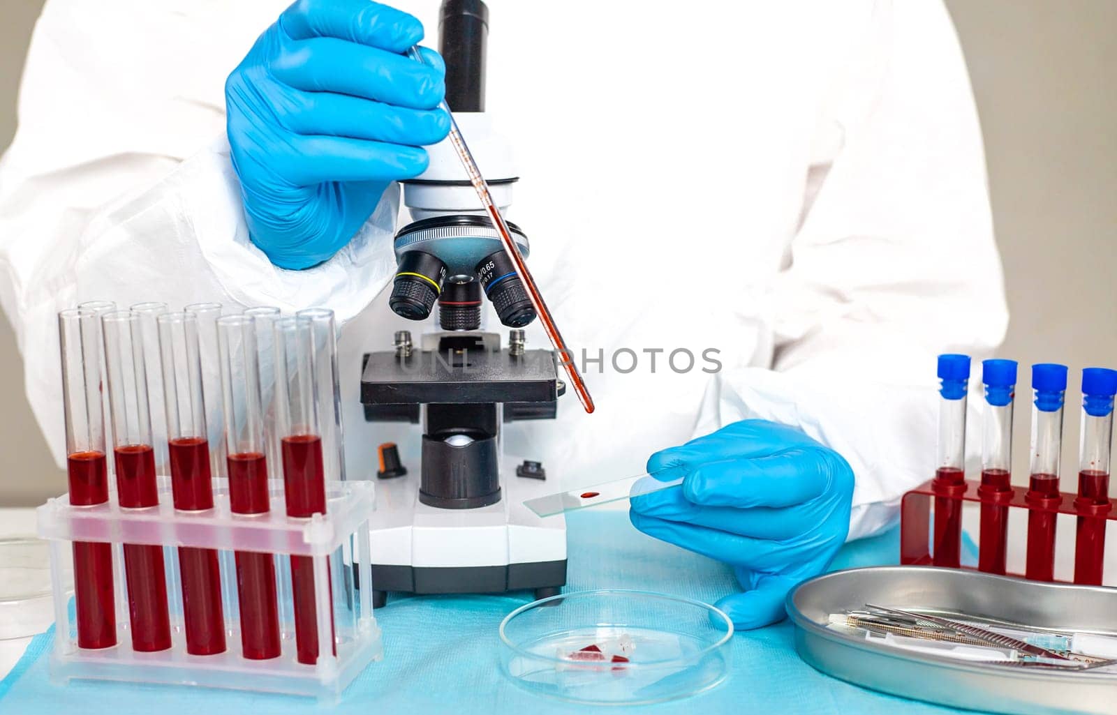 examine blood in the laboratory. Selective focus. medicine.