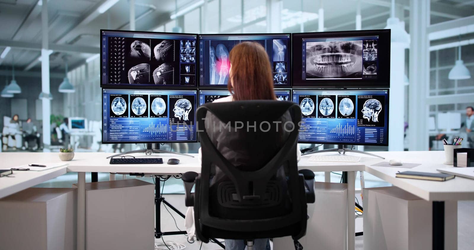 Neurology Doctor Using Radiology Monitoring Computer To Look After Patient's Brain