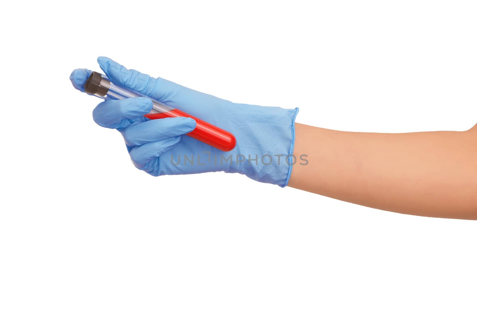 doctor holds a tube with probe of good blood for antidote