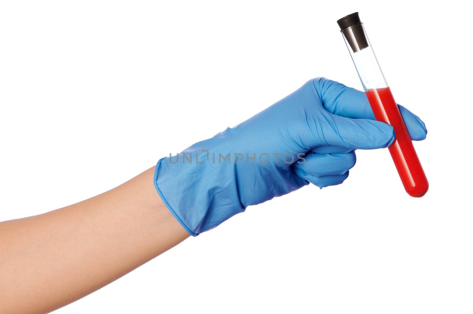 Doctor in blue gloves will be carry out research a samples of bloods at inhabitants of coast on availability of poisoning