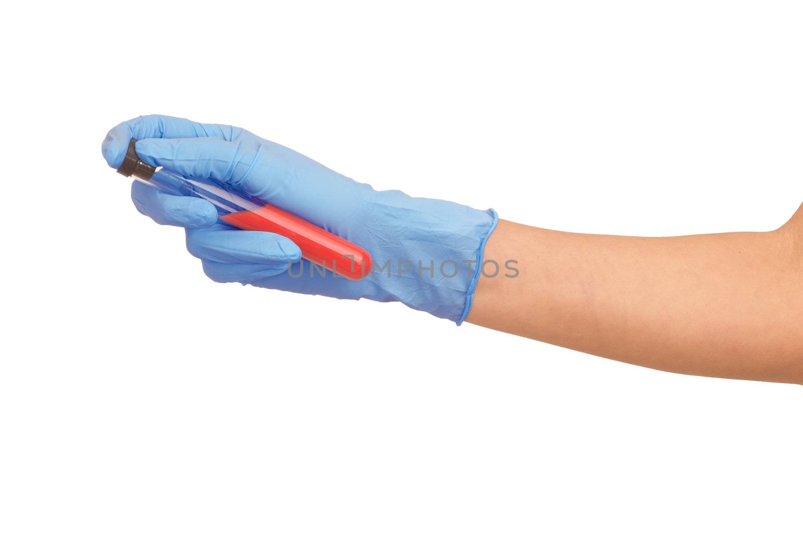 Doctor in blue gloves will be carry out research a samples of bloods at inhabitants of coast on availability of poisoning