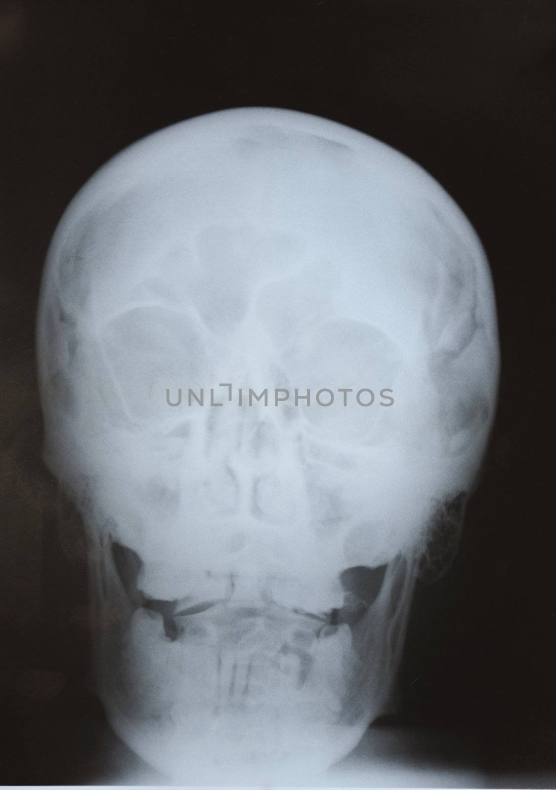 X-Ray skull shot close up