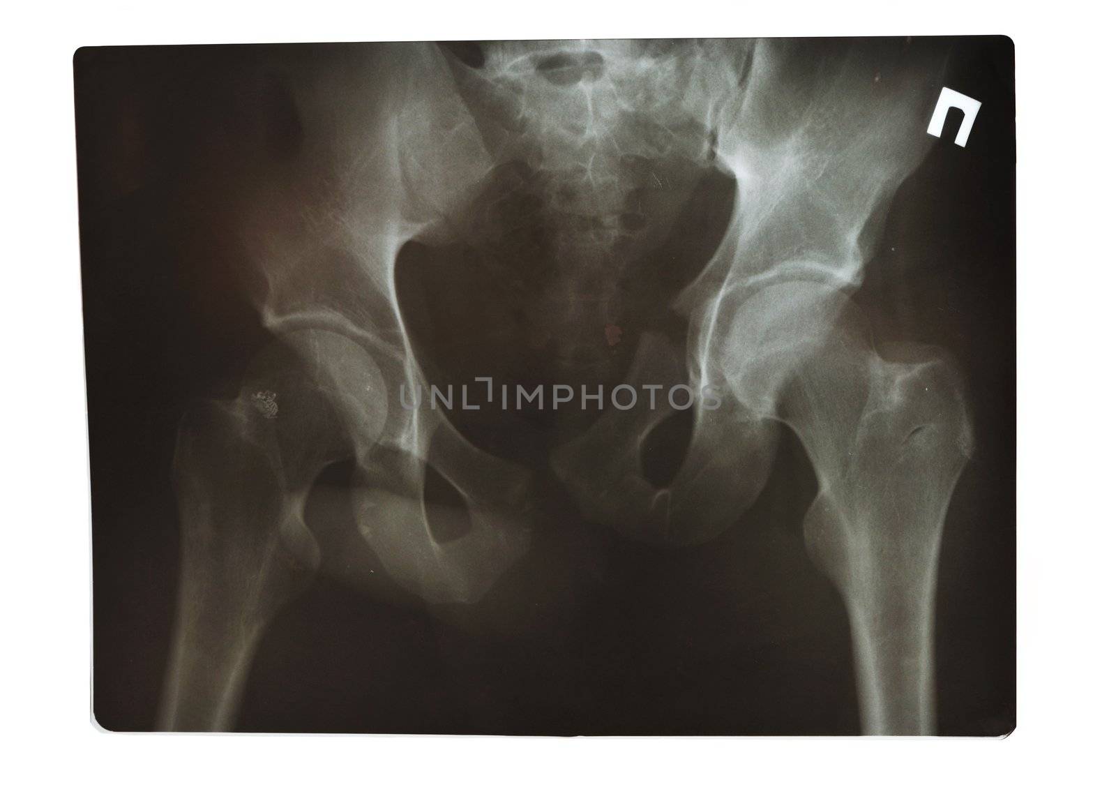 X-Ray shot by haveseen