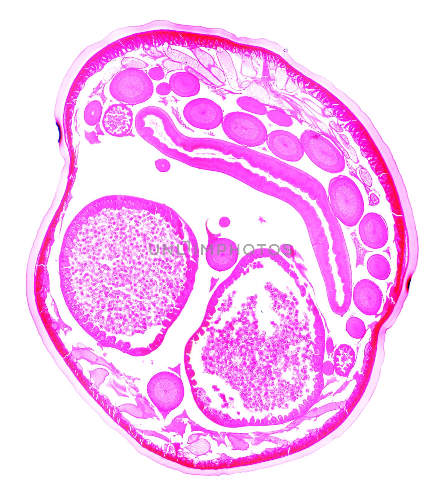 Ascaris under the microscope, background
